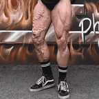 Varicose Veins Relief Cream – Natural Herbal Formula for Smooth, Healthy Legs