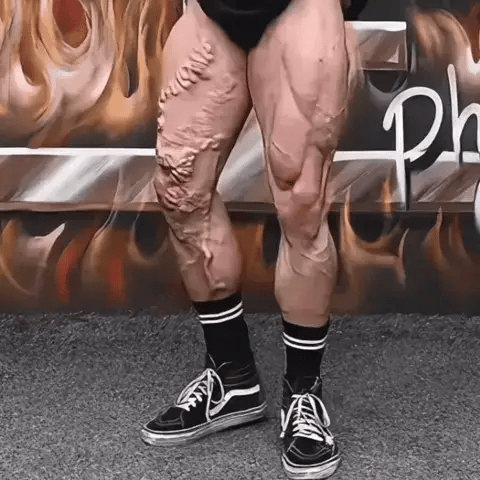 Bee Venom Pain Relief Detox Patches(10 Pcs)  Detox &amp; Slim Effortlessly with Bee Venom Foot Patches!