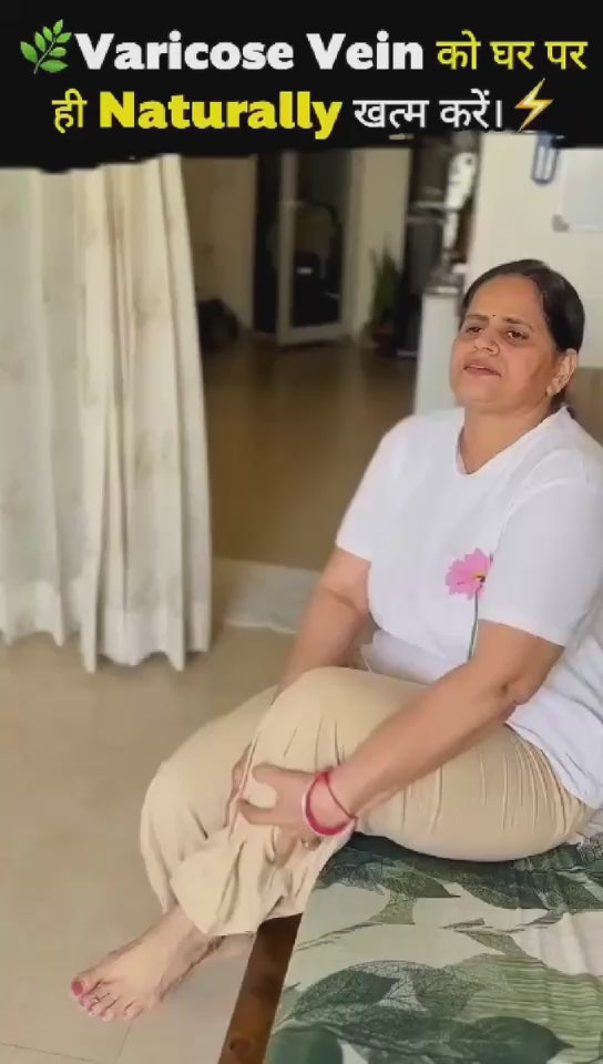 Varicose Veins Relief Cream – Natural Herbal Formula for Smooth, Healthy Legs