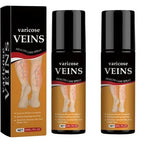 Varicose Veins Relief Cream – Natural Herbal Formula for Smooth, Healthy Legs