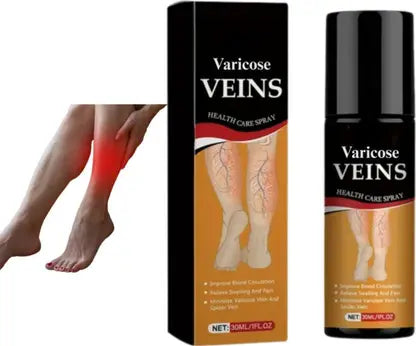 Varicose Veins Relief Cream – Natural Herbal Formula for Smooth, Healthy Legs