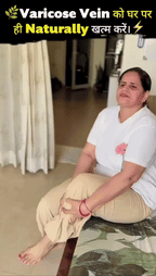 Varicose Veins Relief Cream – Natural Herbal Formula for Smooth, Healthy Legs